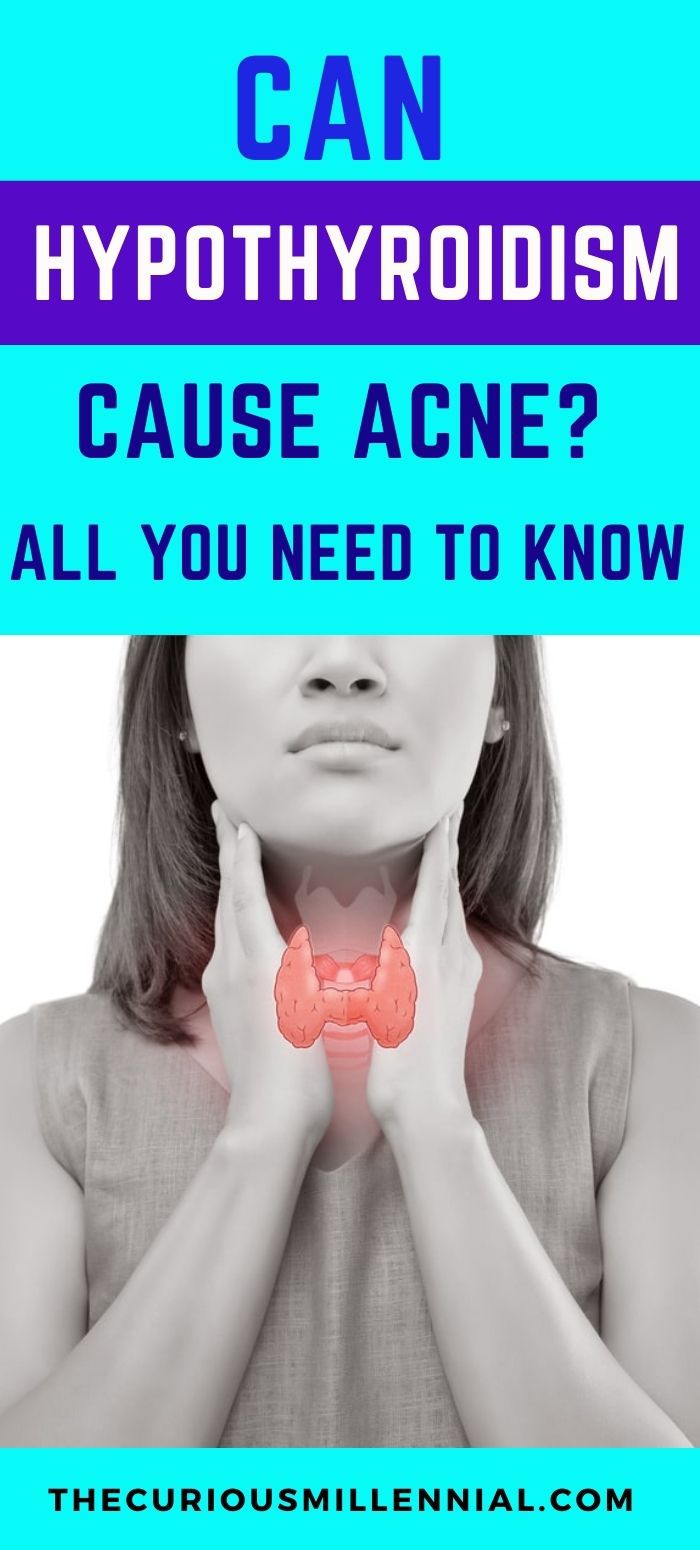 Can Hypothyroidism Cause Acne? What You Need To Know